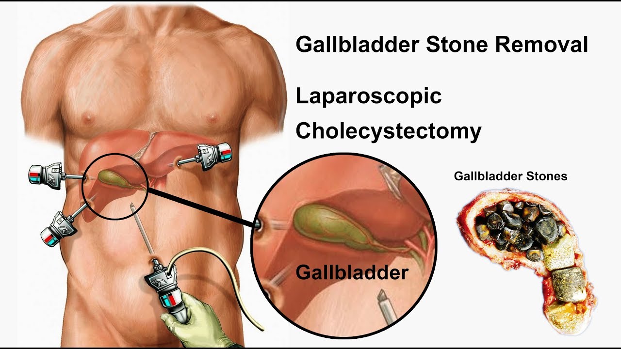 Pancreatic Treatment In Anand