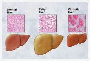 Gastritis Treatment In Anand 