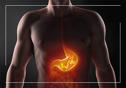 Gastritis Treatment In Anand 