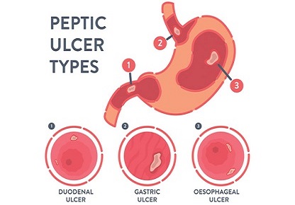 Liver Disease Treatment In Anand